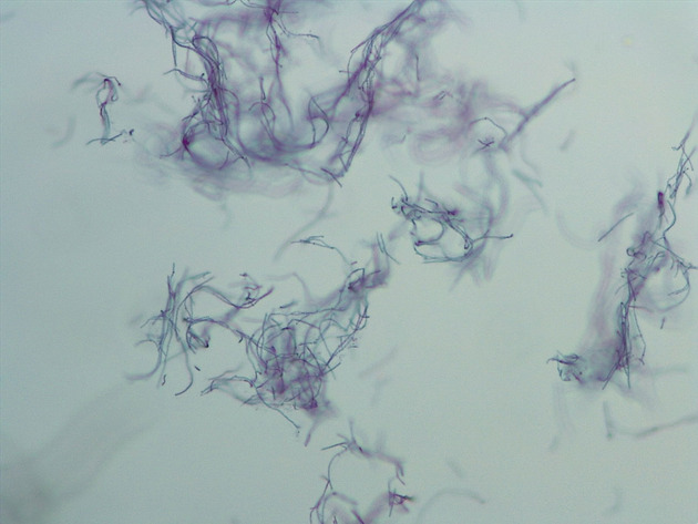 Anabaena Slides - Anabaena 02 100X